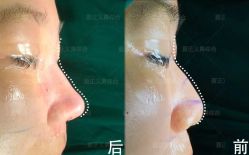 -北京米扬丽格医疗美容·联合丽格鼻整形中心