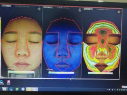 皮肤诊断-光SPA科技美肤