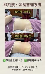 -苗塑堂减肥·艾灸