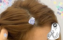 -大麦微针植发全国连锁