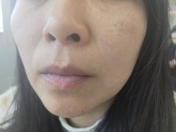 -长沙雅美医疗美容医院