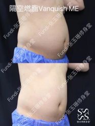 -Fundi张玉珊修身堂·indiba·BTL科技瘦身