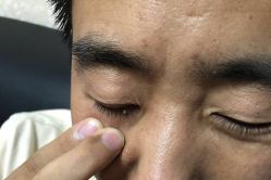 -痣清宫祛斑祛痣连锁店