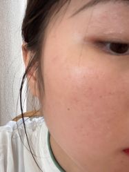 -成都西区医院整形美容