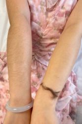 -薇兰专业脱毛连锁机构