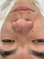 -蕾特恩专业祛痘·皮肤管理