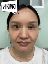 -素美医疗美容·西南眼鼻整形·修复基地