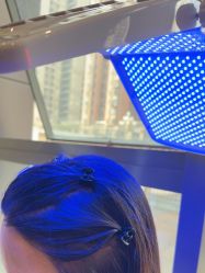 -碧莲盛·不剃发植发