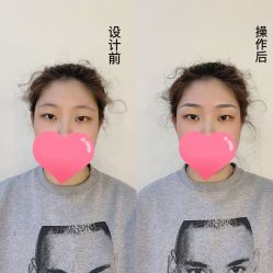 点击看大图 -久匠·纹眉纹绣半永久