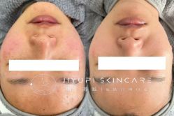 点击看大图 -MLP美丽派·问题肌疗愈中心