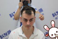 -大麦微针植发丨全国连锁