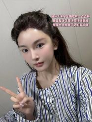 -碧莲盛·不剃发植发