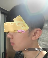 体验后-深圳美莱医疗美容医院