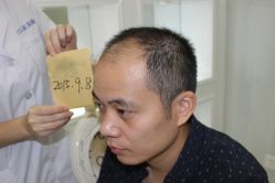 -大麦微针植发丨全国连锁