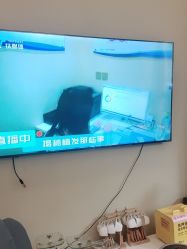 -碧莲盛·不剃发植发