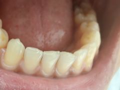 -极光口腔·矫正种植修复(锦江院区)