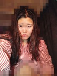 点击看大图 -禾美嘉医疗美容