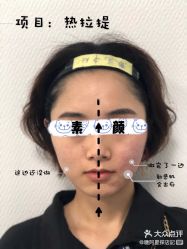 -八大处整形