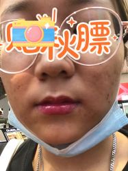 体验前-美莱医疗美容医院
