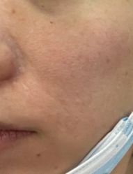 体验后-柒朵科技美肤中心