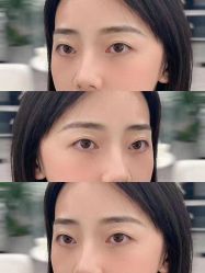 点击看大图 -张小野·专业半永久纹眉