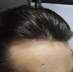 -发饰美男士增发补发假发定制店