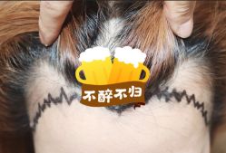 -大麦微针植发全国连锁