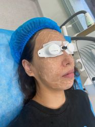 体验前-SKINIST丽铂医疗美容