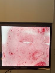 -苑苑vbeauty科技美容SPA