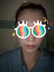 体验后-纯粹医美