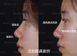 -北京米扬丽格医疗美容·联合丽格鼻整形中心