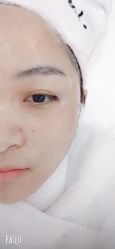 体验后-Metime美天医疗美容