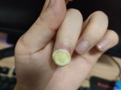 -世龙世家甲沟炎·灰指甲·嵌甲矫正·修脚(武侯区双楠店)