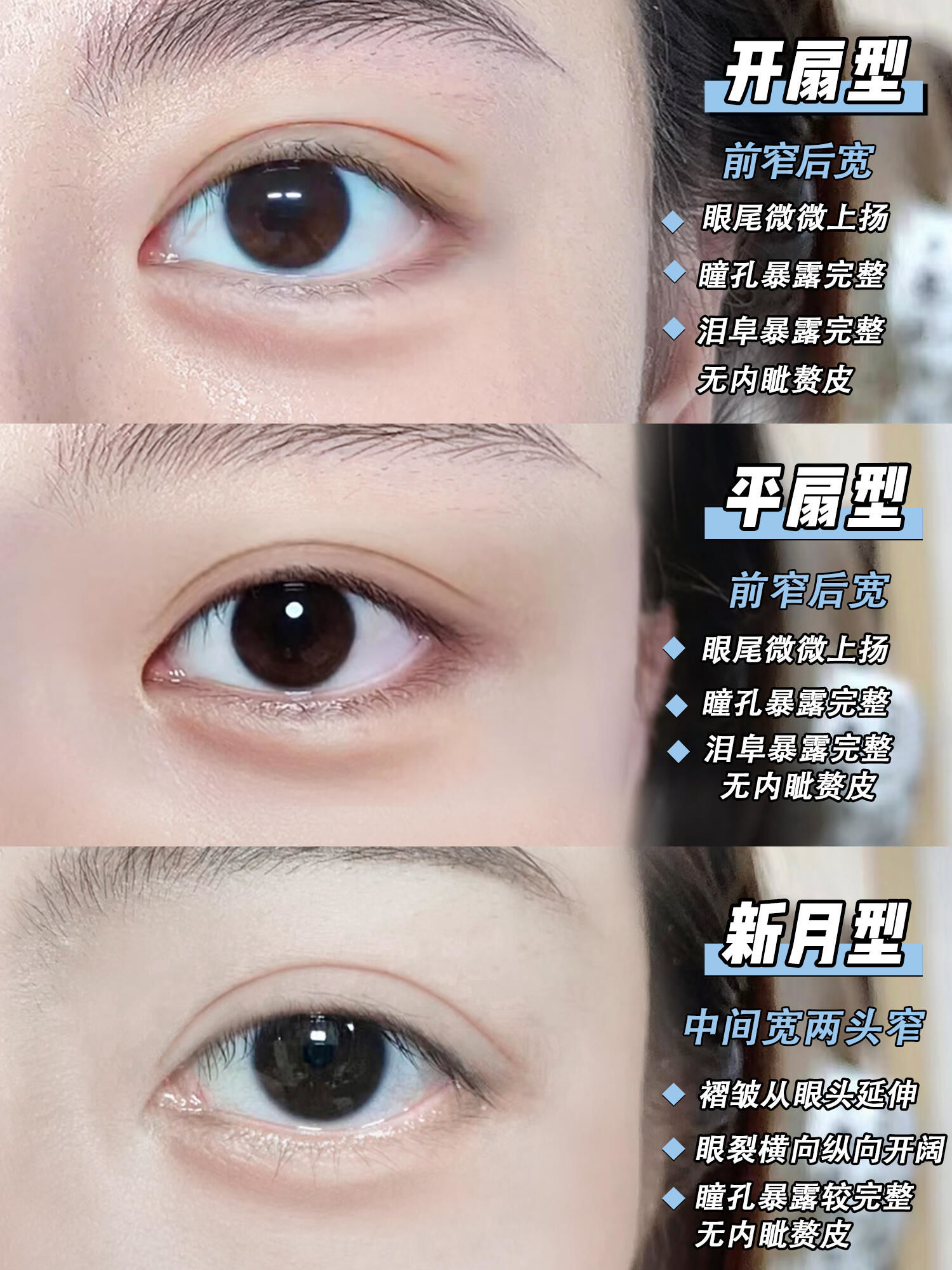 这5种双眼皮形态,你适合哪一种