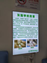 点击看大图 -德哥灰指甲脚气甲沟炎跖疣护理