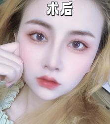 -素美医疗美容·西南眼鼻整形·修复基地