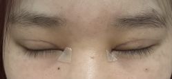 -JustHer宁波珈禾医疗美容医院