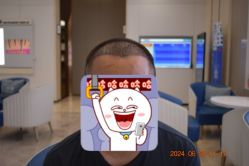 体验后-大麦微针植发全国连锁