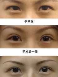 -美莱医学美容医院