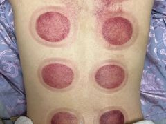 -华集正·专业正骨推拿(集美店)