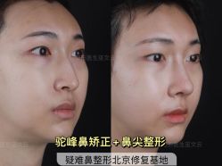 -北京米扬丽格医疗美容·联合丽格鼻整形中心