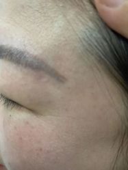-郡艺医疗美容·微整·眼鼻吸脂