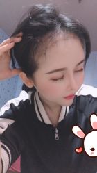 -大麦微针植发丨全国连锁