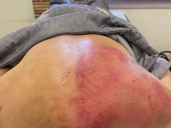 -艾之灸养生馆·推拿·艾灸