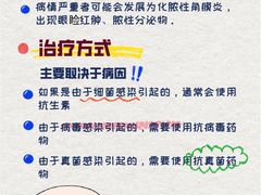 -上海大学附属上海和平眼科医院