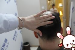 -大麦微针植发丨全国连锁