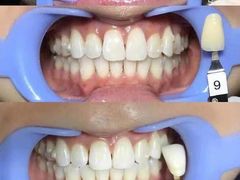 -齐玉齿科JADENTAL