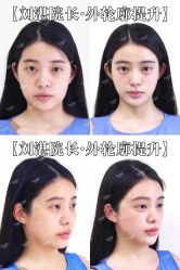 -Yestar宁波艺星整形医院