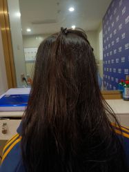 -碧莲盛·不剃发植发