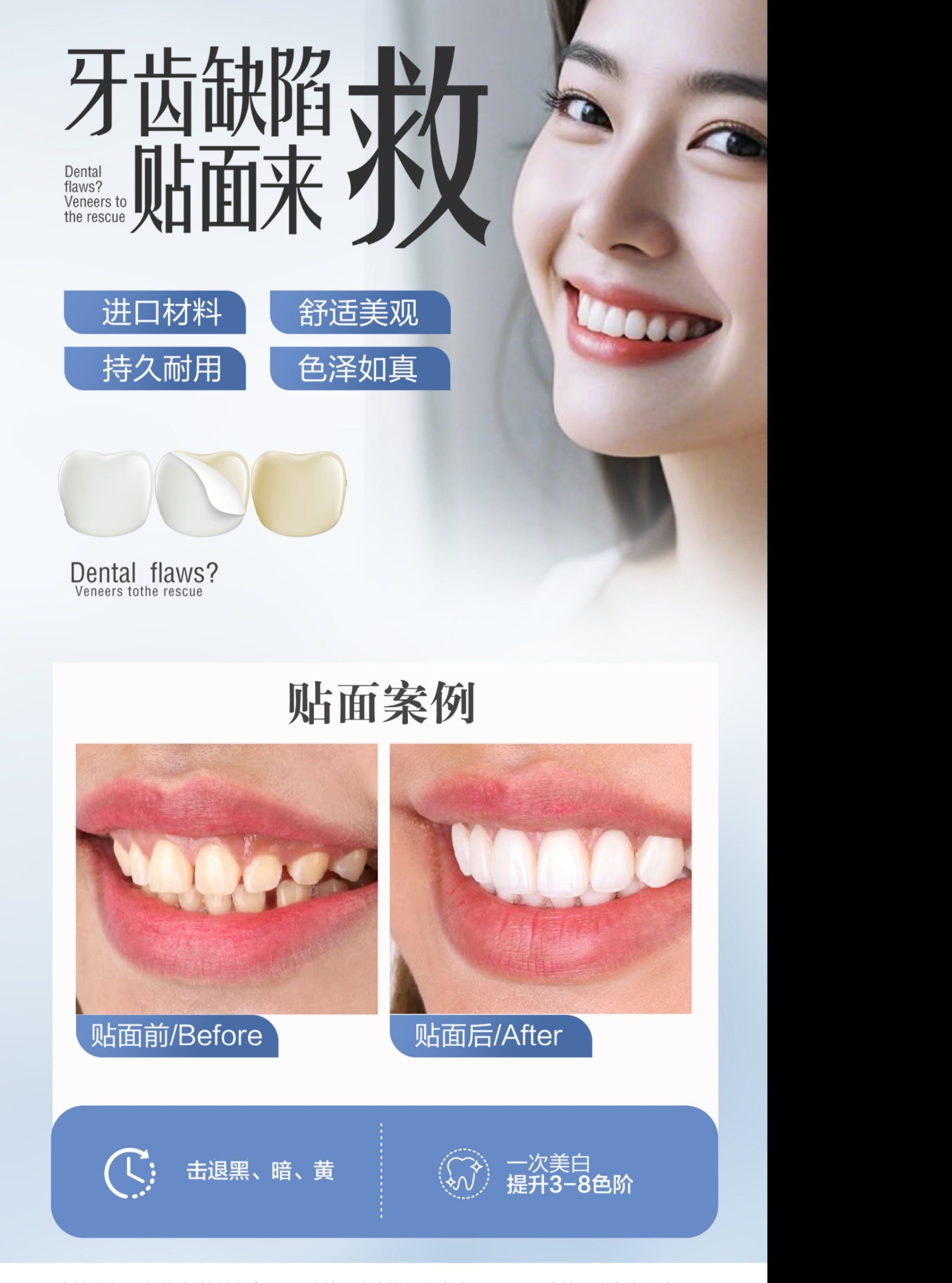 🦷超薄全瓷贴面的魅力